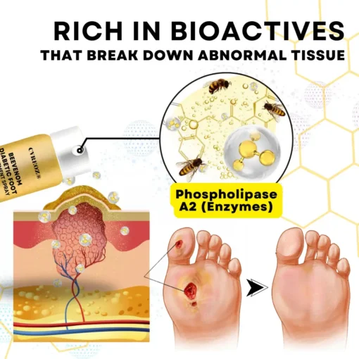CVREOZ® Bee Venom Diabetic Foot Treatment Spray