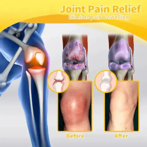 Cvreoz® Bee-Venom Pain-Relief Bone Healing Cream