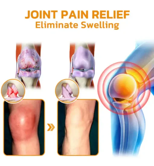 Cvreoz® Bee-Venom Pain-Relief Bone Healing Cream