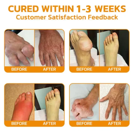 Cvreoz® Bee-Venom Pain-Relief Bone Healing Cream