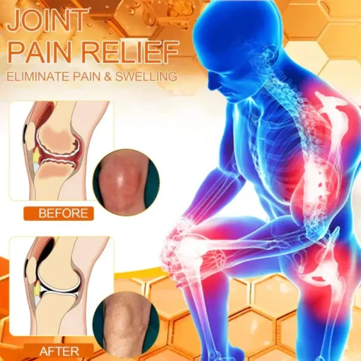 Cvreoz® Bee-Venom Pain-Relief Bone Healing Cream