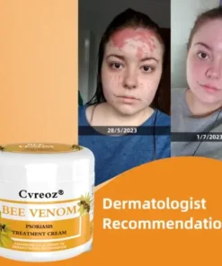 Cvreoz® Bee Venom Psoriasis Treatment Cream