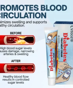 Cvreoz® Diabetes Treatment Cream