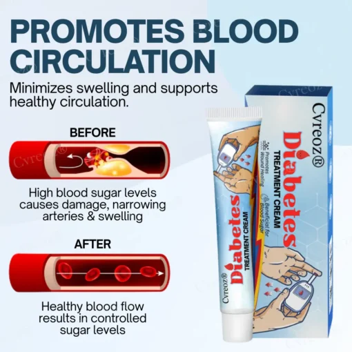 Cvreoz® Diabetes Treatment Cream