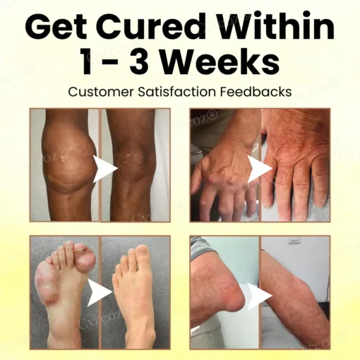 Cvreoz® Magnesium Oil & Bee Venom Joint Healing Spray