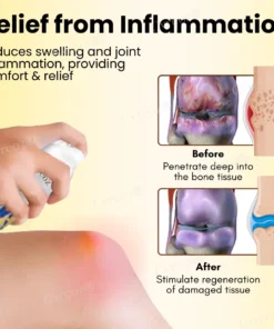 Cvreoz® Magnesium Oil & Bee Venom Joint Healing Spray