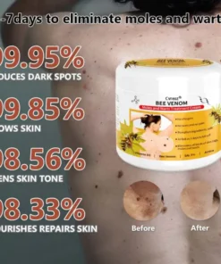 Cvreoz® PRO Bee Venom Mole and Wart Treatment Cream