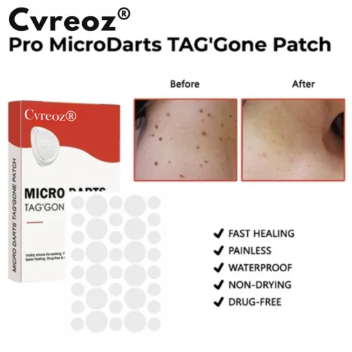 Cvreoz® Parche TAG' Gone de Pro Micro Darts
