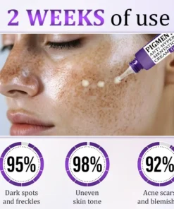 Cvreoz® PigmentaX ProFade Anti-Hyperpigmentation Cream