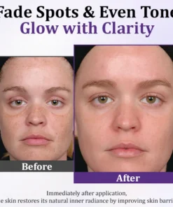Cvreoz® PigmentaX ProFade Anti-Hyperpigmentation Cream