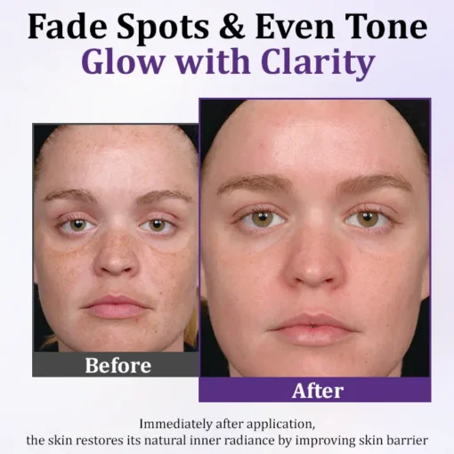 Cvreoz® PigmentaX ProFade Anti-Hyperpigmentation Cream