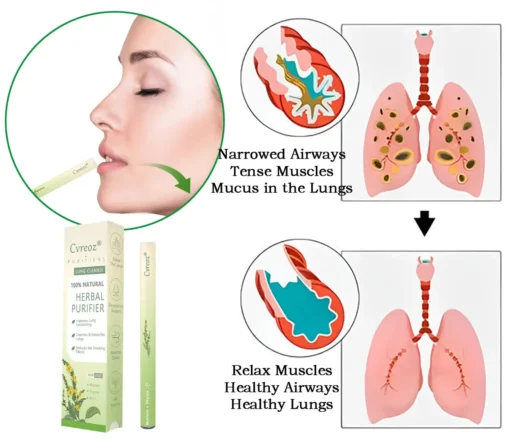 𝐂𝐯𝐫𝐞𝐨𝐳® 𝐌𝐮𝐥𝐥𝐞𝐢𝐧 𝐇𝐞𝐫𝐛𝐚𝐥 𝐋𝐮𝐧𝐠 𝐏𝐮𝐫𝐢𝐟𝐢𝐞𝐫