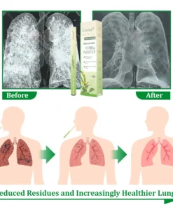 𝐂𝐯𝐫𝐞𝐨𝐳® 𝐌𝐮𝐥𝐥𝐞𝐢𝐧 𝐇𝐞𝐫𝐛𝐚𝐥 𝐋𝐮𝐧𝐠 𝐏𝐮𝐫𝐢𝐟𝐢𝐞𝐫