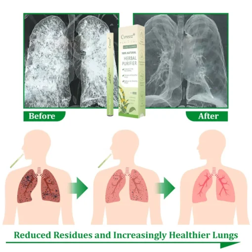 𝐂𝐯𝐫𝐞𝐨𝐳® 𝐌𝐮𝐥𝐥𝐞𝐢𝐧 𝐇𝐞𝐫𝐛𝐚𝐥 𝐋𝐮𝐧𝐠 𝐏𝐮𝐫𝐢𝐟𝐢𝐞𝐫