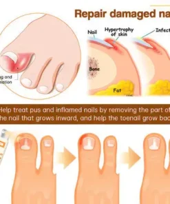 CVREOZ® Bee Venom Nail Fungus Spray