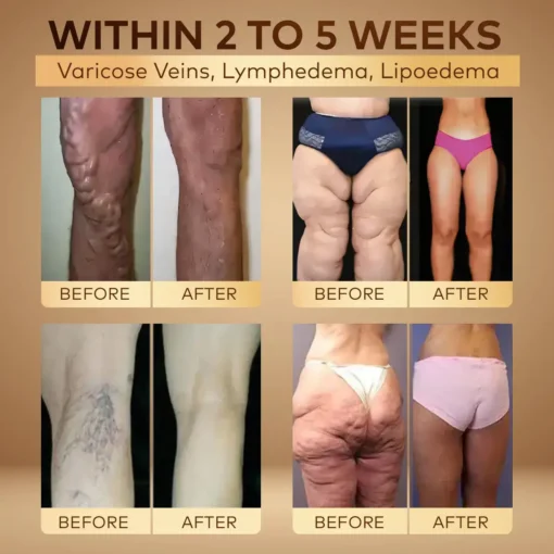 CVREOZ® GLP-1 Slimming and Health Boost Drop