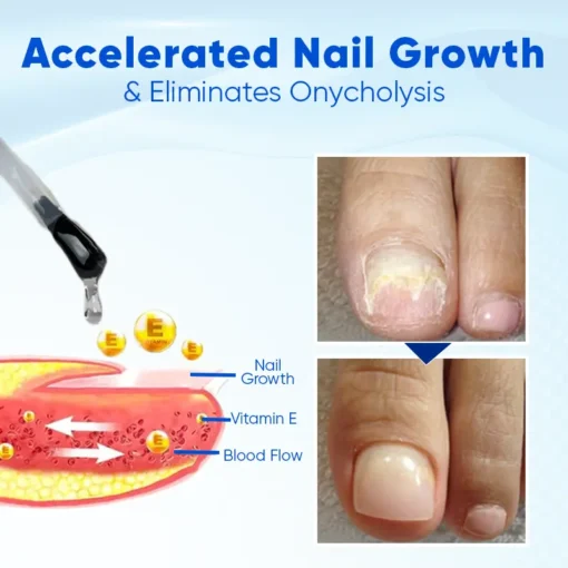 CVREOZ® NailGuard Nail Growth and Repair Serum