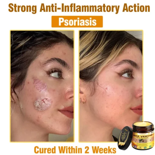 Cvreoz® Bee Venom All-in-One Cream