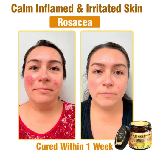 Cvreoz® Bee Venom All-in-One Cream