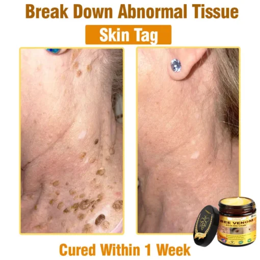Cvreoz® Bee Venom All-in-One Cream