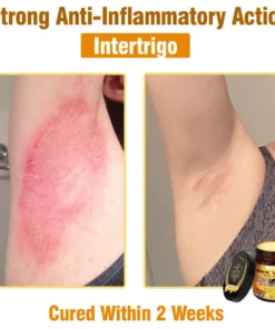 Cvreoz® Bee Venom All-in-One Cream