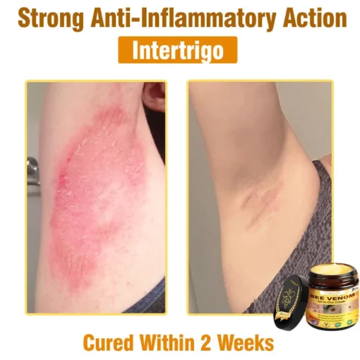 Cvreoz® Bee Venom All-in-One Cream