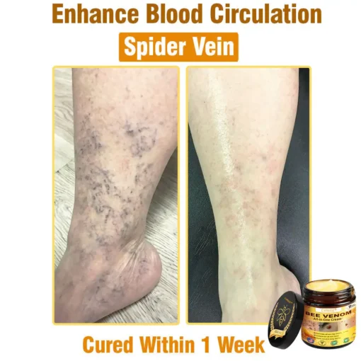 Cvreoz® Bee Venom All-in-One Cream