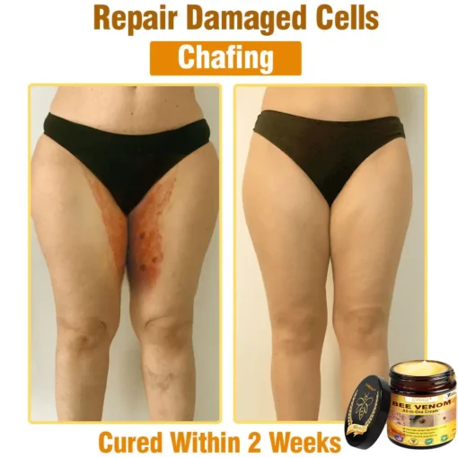 Cvreoz® Bee Venom All-in-One Cream