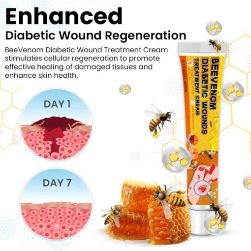 Cvreoz™ Bee Venom Diabetic Wounds Treatment Cream