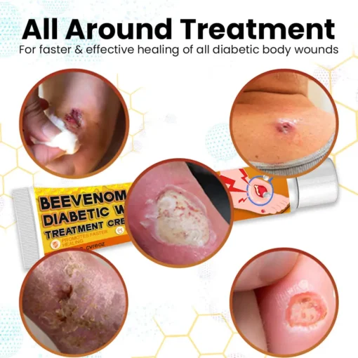 Cvreoz™ Bee Venom Diabetic Wounds Treatment Cream