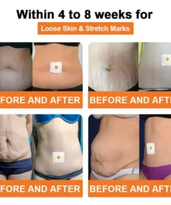 Cvreoz® Bee Venom Lymphatic Drainage Slimming Patch