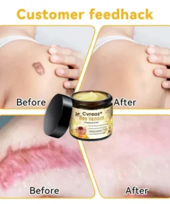 Cvreoz® Bee Venom Skin Treatment Cream