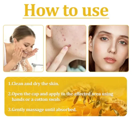 Cvreoz® Bee Venom Skin Treatment Cream