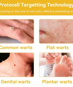 Cvreoz® Bee Venom Skin Treatment Cream