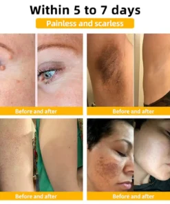 Cvreoz® Bee Venom Skin Treatment Cream