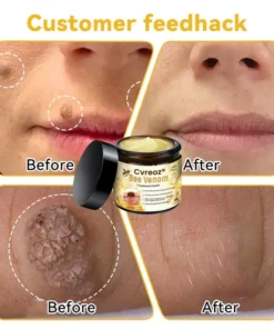 Cvreoz® Bee Venom Skin Treatment Cream