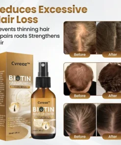 Cvreoz® Biotin Hair Growth Premium Serum