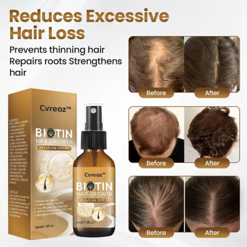 Cvreoz® Biotin Hair Growth Premium Serum