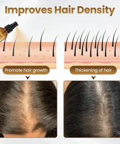 Cvreoz® Biotin Hair Growth Premium Serum