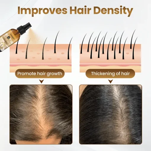 Cvreoz® Biotin Hair Growth Premium Serum