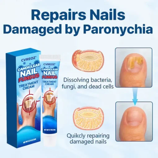 Cvreoz® Candiclear Nail Fungus Treatment Cream