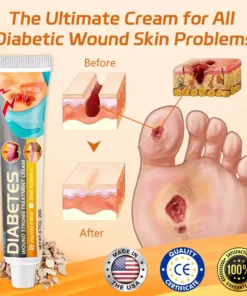 Cvreoz® Diabetes Wound Strong Treatment Cream