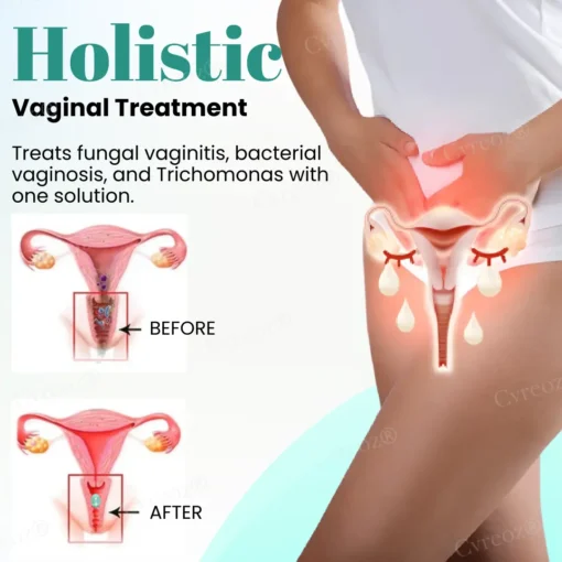 Cvreoz® Female Intimate Care Capsules