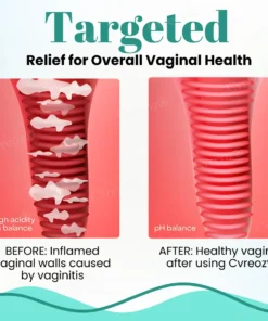 Cvreoz® Female Intimate Care Capsules