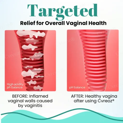 Cvreoz® Female Intimate Care Capsules