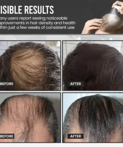 Cvreoz® FollicleBoost Hair Growth Treatment Spray