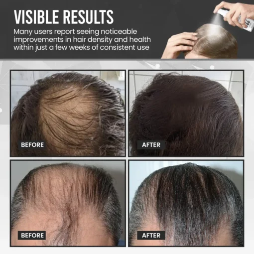 Cvreoz® FollicleBoost Hair Growth Treatment Spray