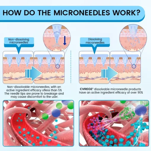 Cvreoz® GlucaLite GLP-1 Nano Microneedle Patch