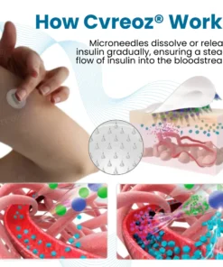Cvreoz® InsuliNeedle Glucose Control Microneedling Patch