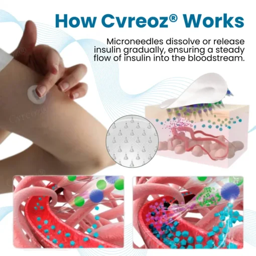 Cvreoz® InsuliNeedle Glucose Control Microneedling Patch